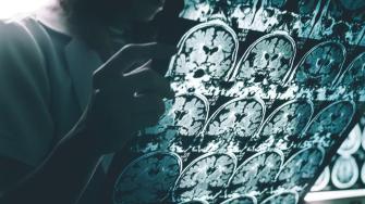 La prueba, desarrollada por la multinacional japonesa Fujirebio Diagnostics, mide la proporción de dos proteínas en la sangre.
Para más información del tema, visita: https://www.eleconomista.com.mx/arteseideas/eu-aprueba-inedito-primer-analisis-sangre-detectar-alzheimer-20250516-759442.html
¡Síguenos en nuestras redes sociales para mantenerte informado!
Twitter: https://twitter.com/eleconomista
Facebook: https://www.facebook.com/ElEconomista.mx
Instagram: https://www.instagram.com/eleconomistamx
LinkedIn: https://www.linkedin.com/company/el-economista/
#ElEconomista #EETV